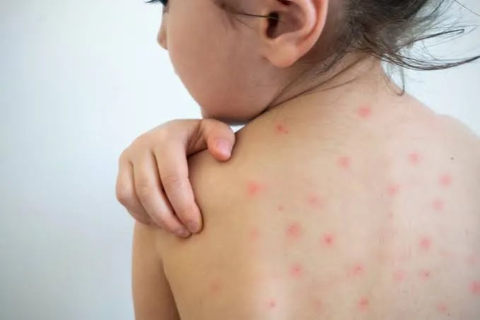 DIVULGAÇÃO/PREFEITURA DE TRÊS LAGOAS