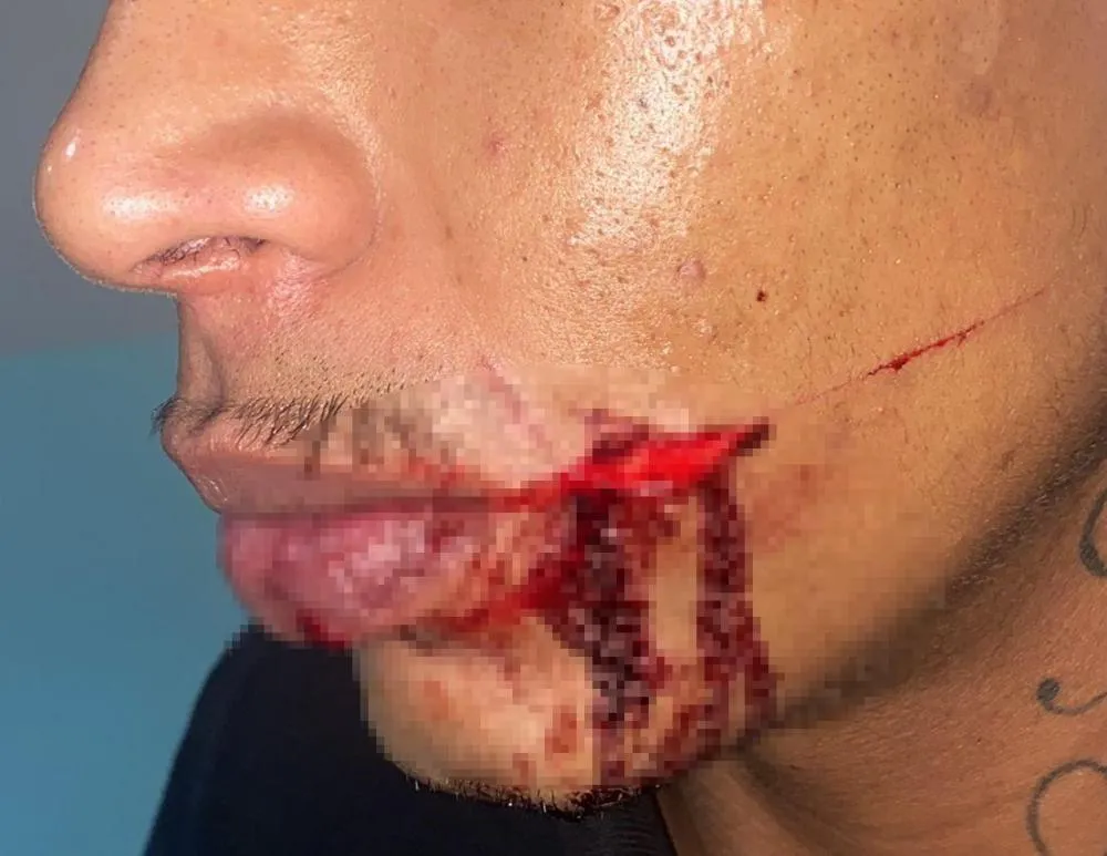 MARCO CAMPOS/ TL NOTÍCIAS